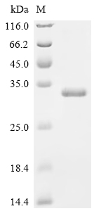 SDS-PAGE