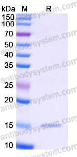 AHJ41202, SDS-PAGE