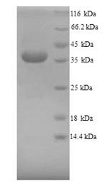 SDS-PAGE