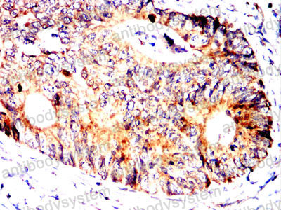 Валидация AntibodySystem RHK06403