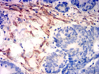 Валидация AntibodySystem RHG05603