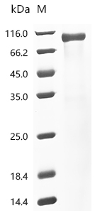 SDS-PAGE