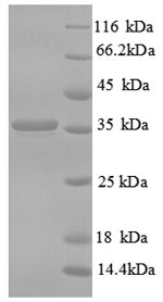 SDS-PAGE