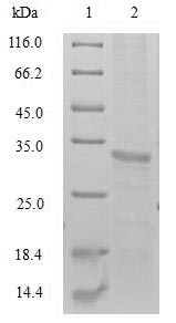 SDS-PAGE
