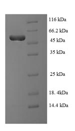 SDS-PAGE
