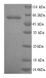 SDS-PAGE