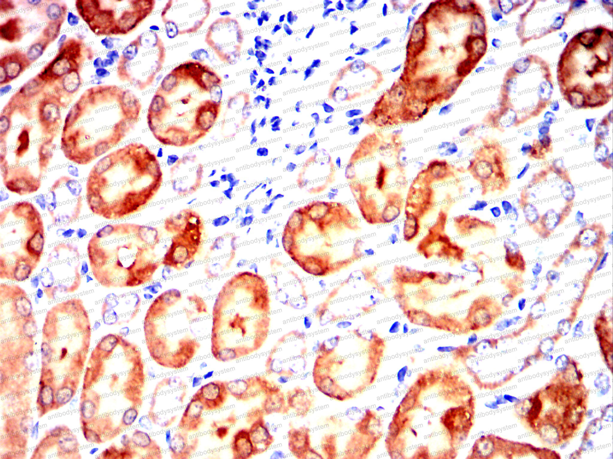 Валидация AntibodySystem RHF42104