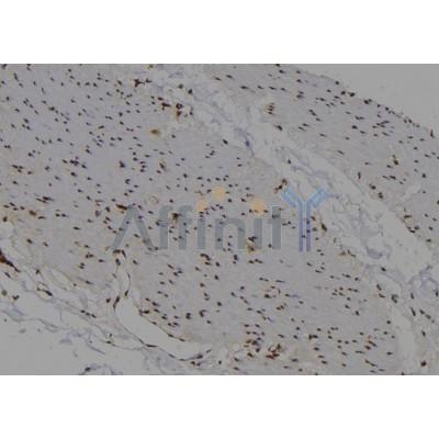 Валидация Affinity DF4351 - 15802