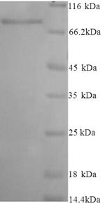 SDS-PAGE