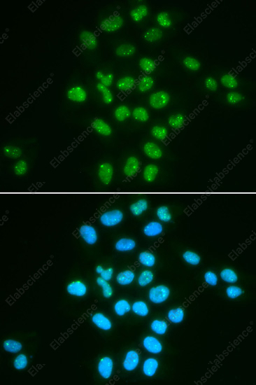 Иммунофлуоресценция, BMI1, клетки HeLa