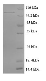 SDS-PAGE