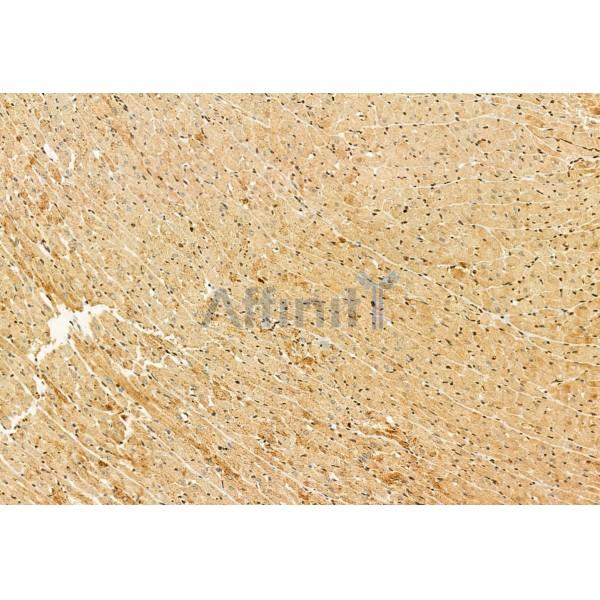 Валидация Affinity DF12082 - 6171