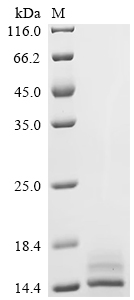 SDS-PAGE