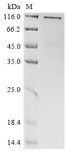 SDS-PAGE