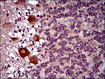 Валидация AntibodySystem RHA11501