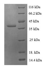 SDS-PAGE