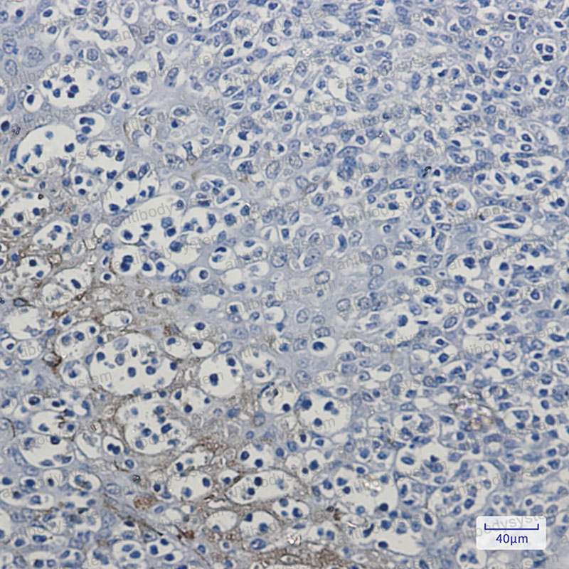 Валидация AntibodySystem RHD87201