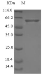 SDS-PAGE