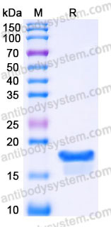 YHC06302, SDS-PAGE