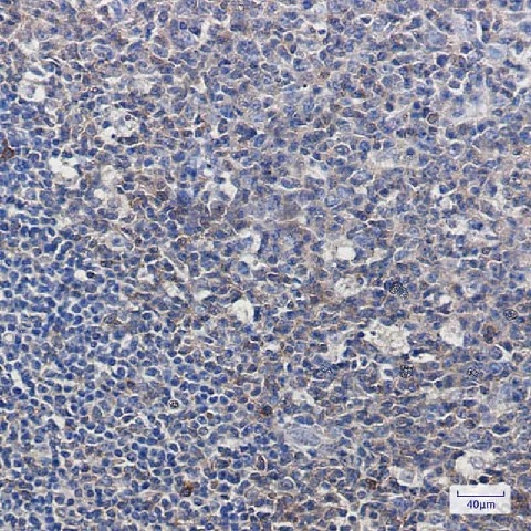 Иммуногистохимия, pro Caspase 3, ткань миндалин человека