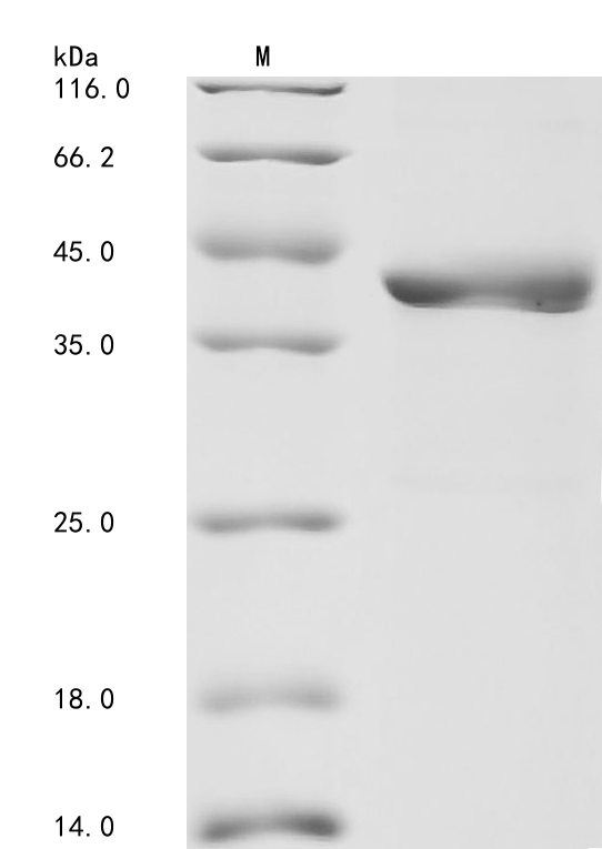 SDS-PAGE