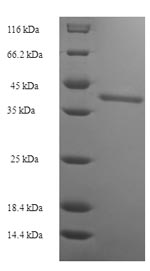 SDS-PAGE