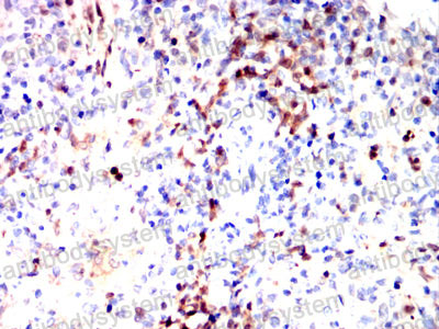 Валидация AntibodySystem RHD71003 (1753)