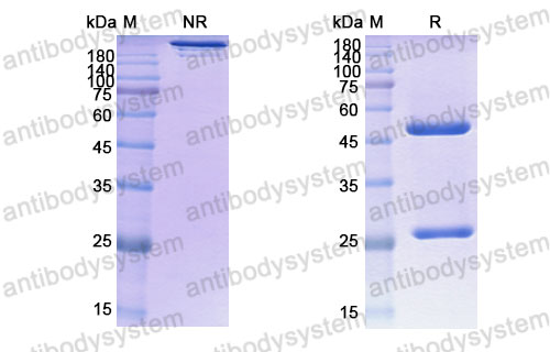 Валидация SDS-PAGE - AntibodySystem DHE43207