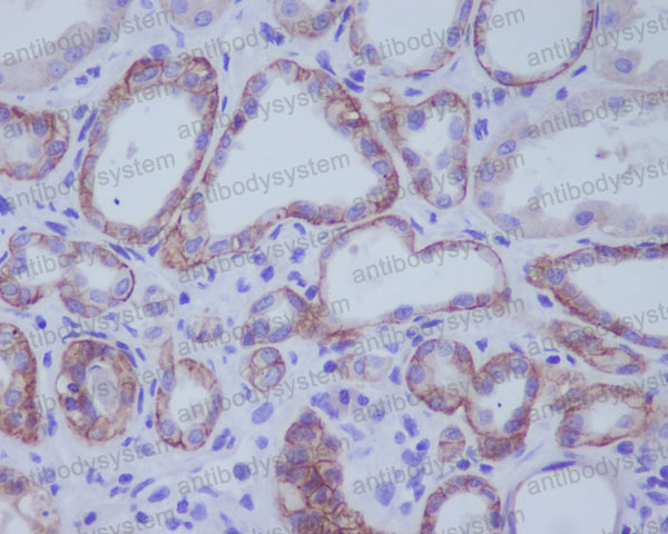 Валидация AntibodySystem RHJ51602