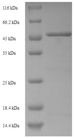 SDS-PAGE