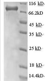 SDS-PAGE