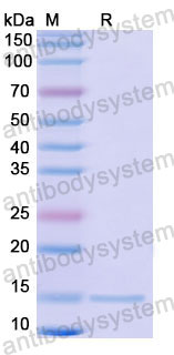 Валидация SDS-PAGE - AntibodySystem RHD41002