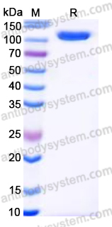 EHC14301, SDS-PAGE