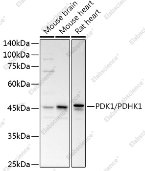 Вестерн-блоттинг, PDK1/PDHK1, различные клеточные линии