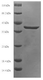 SDS-PAGE