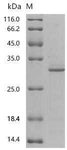 SDS-PAGE