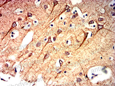 Валидация AntibodySystem RHC33012