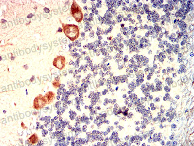 Валидация AntibodySystem RHJ53201