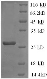 SDS-PAGE