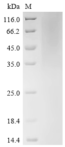 SDS-PAGE