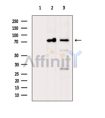 Валидация Affinity DF15179 - 11452