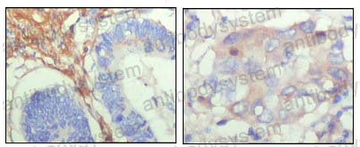 Валидация AntibodySystem RHJ74002