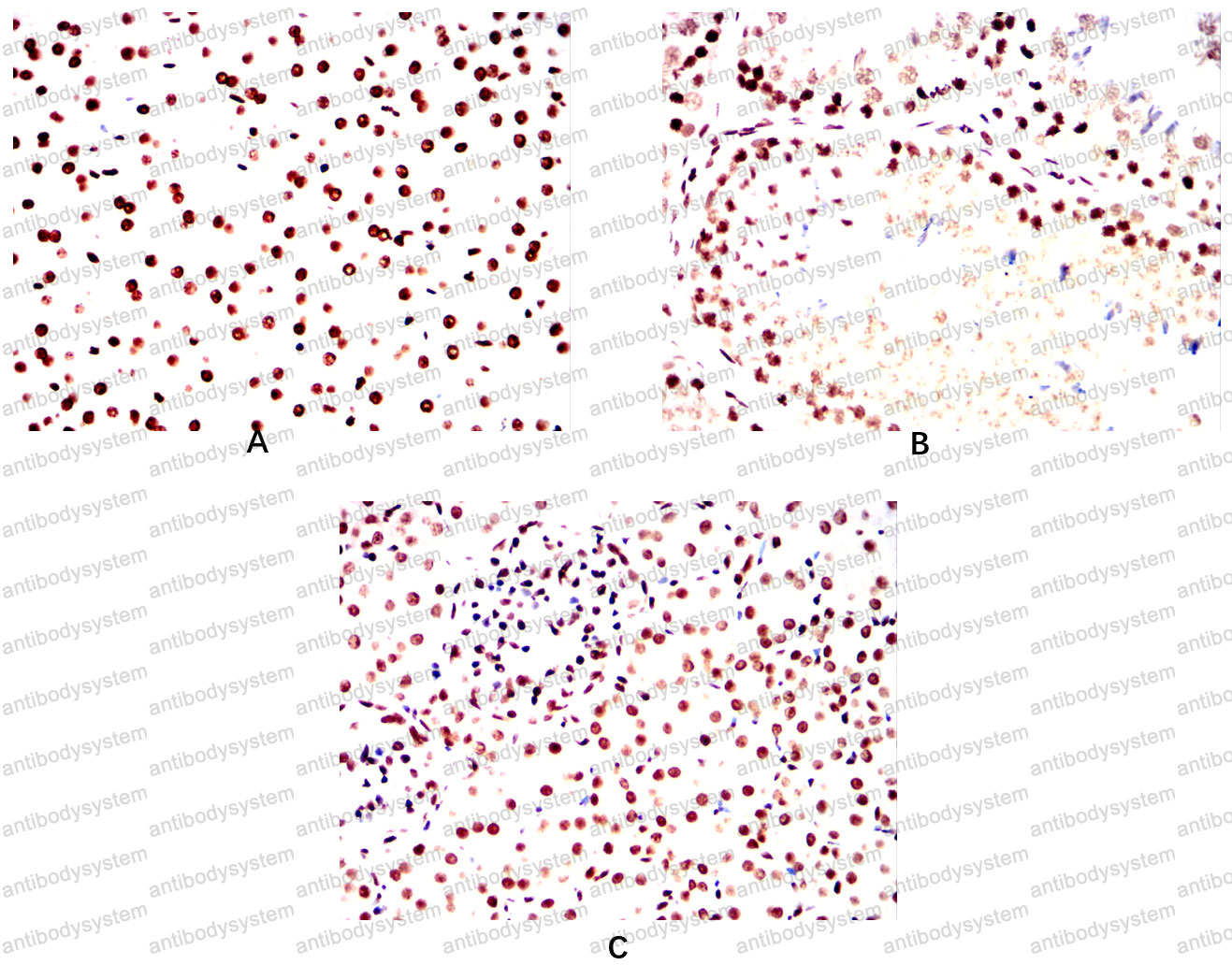 Валидация AntibodySystem RHE37704