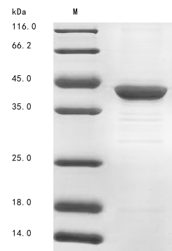 SDS-PAGE
