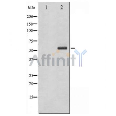 Валидация Affinity AF6007 - 3192