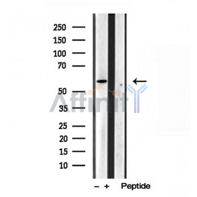 Валидация Affinity DF12029 - 6055