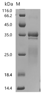 SDS-PAGE