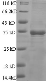 SDS-PAGE