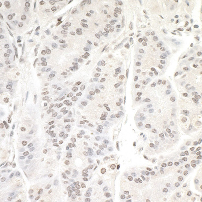 Валидация AssayVector ARM2216(3696)