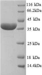 SDS-PAGE